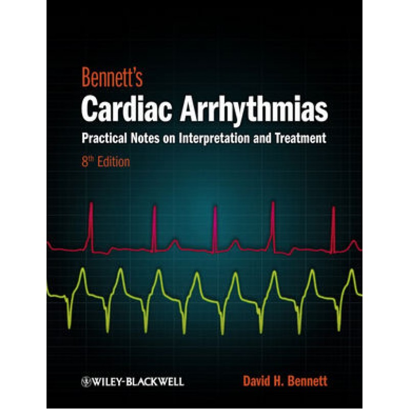Bennett's Cardiac Arrhythmias: Practical Notes on Interpretation and Treatment, 8th Edition